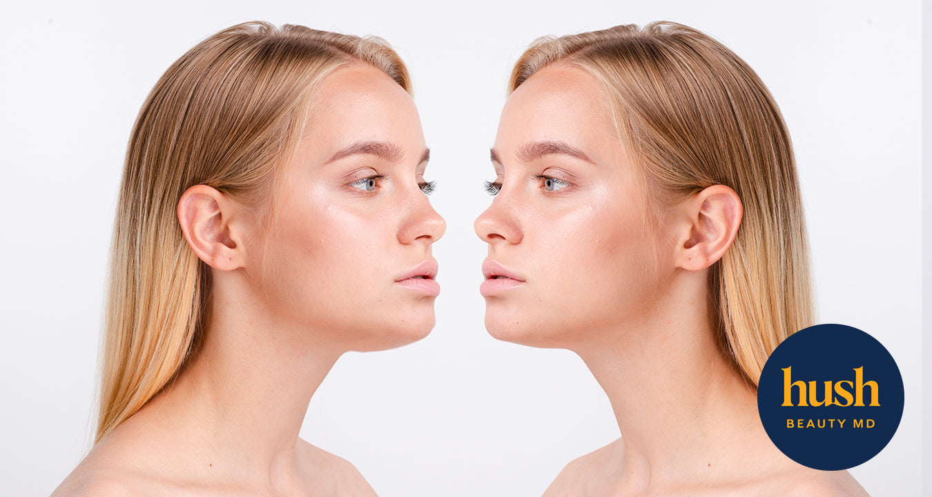 What We Wish Clients Knew About Belkyra Treatment in Vancouver
