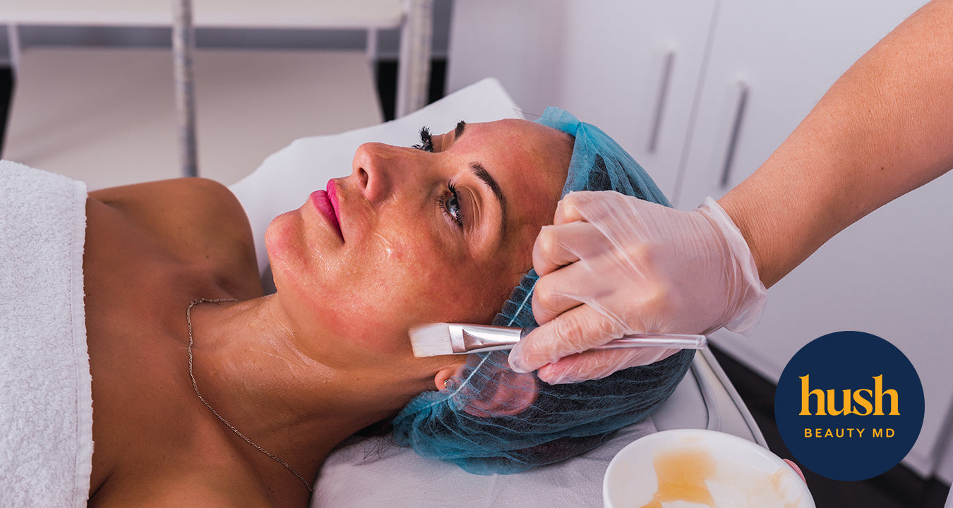 What You Should Stop Believing About Chemical Peel Treatment in Vancouver