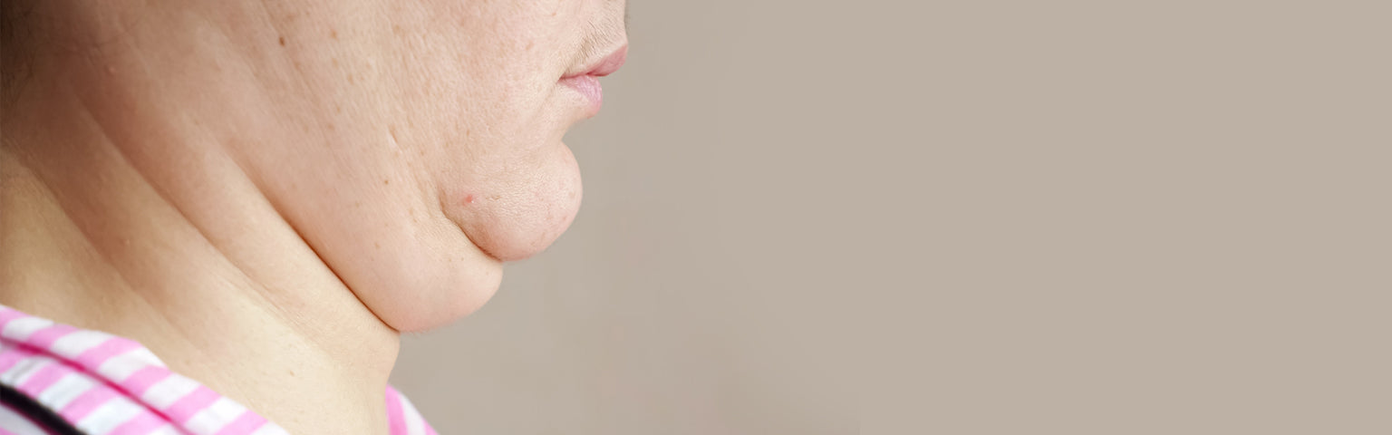 Double Chin treatment options at Hush Beauty MD