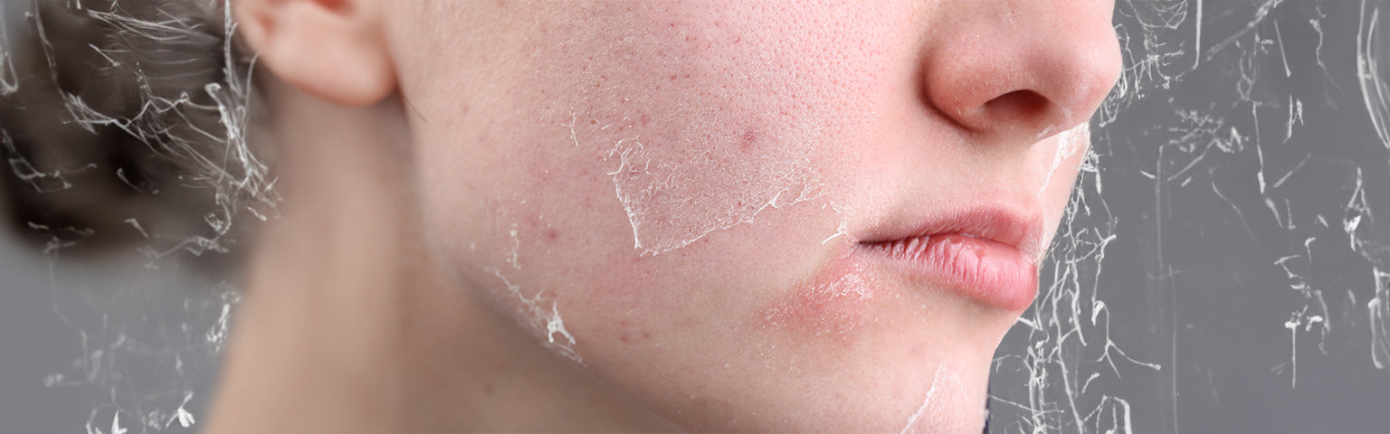Dull Skin treatment options at Hush Beauty MD