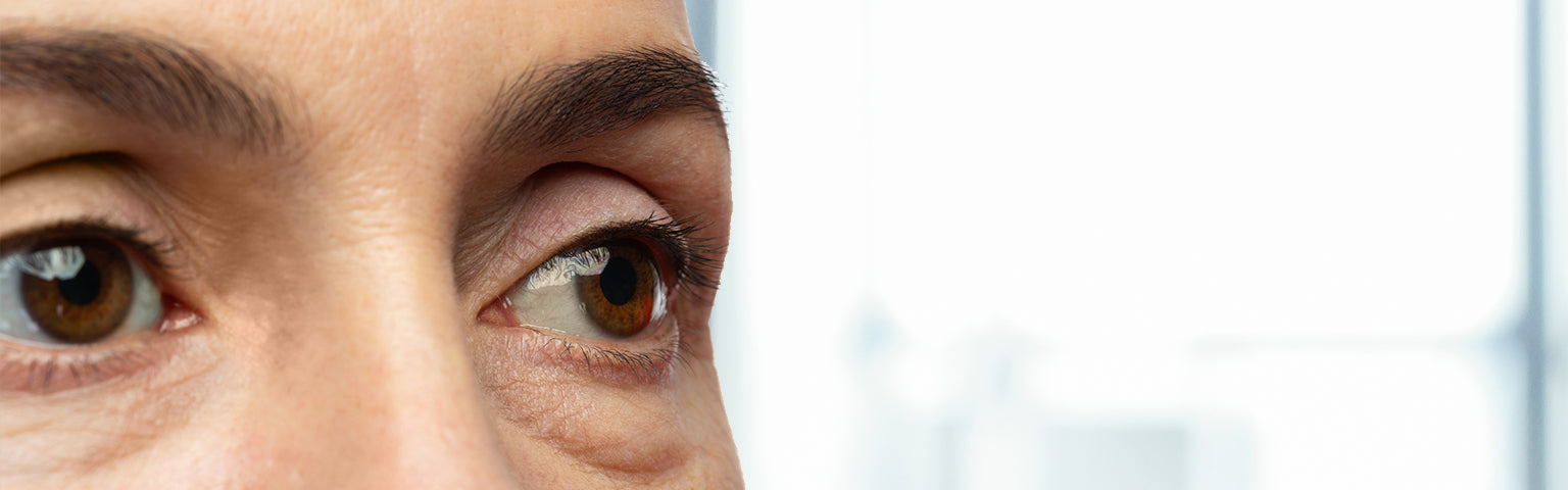 Eye Bags treatment options at Hush Beauty MD