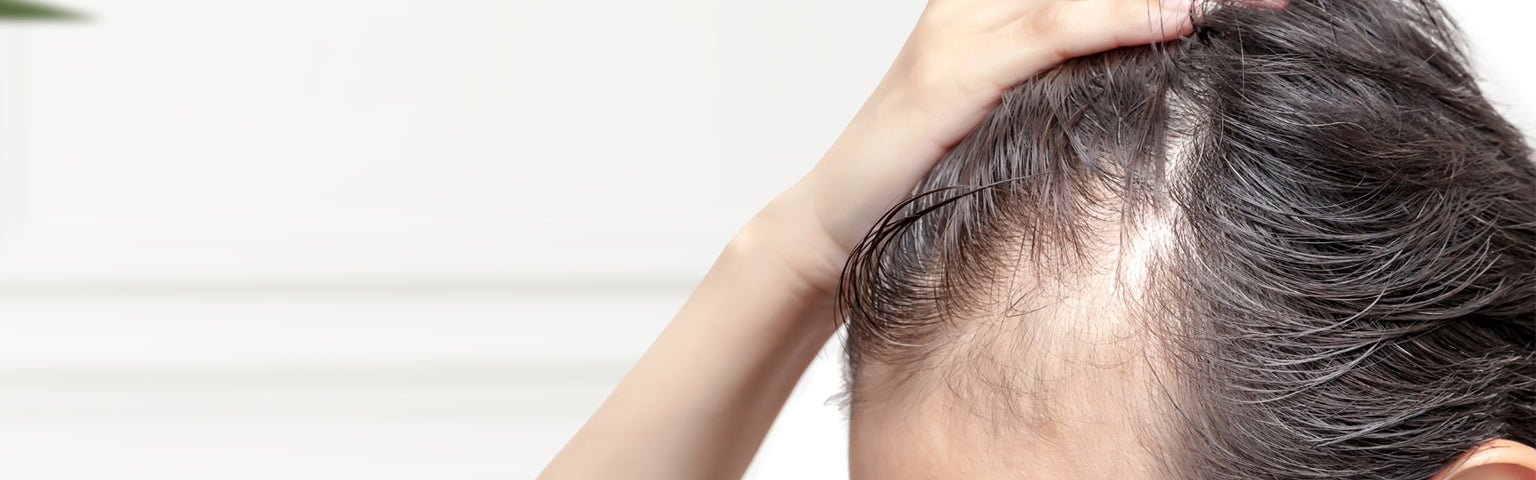 Hair Loss treatment options at Hush Beauty MD