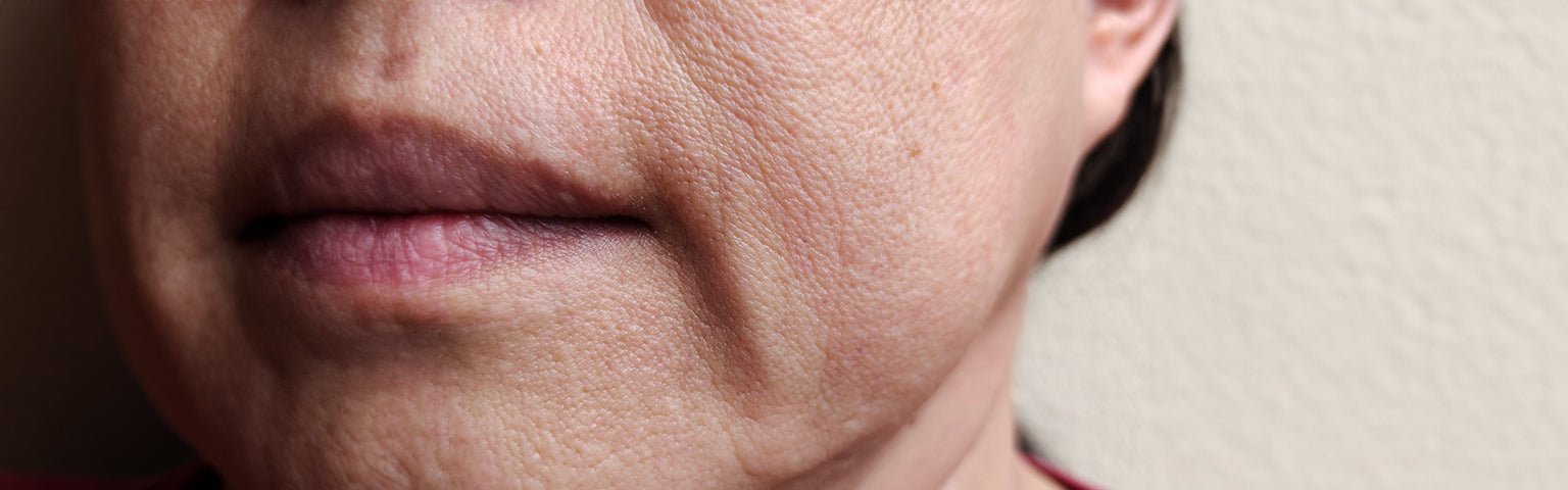 Jowls Treatment treatment options at Hush Beauty MD