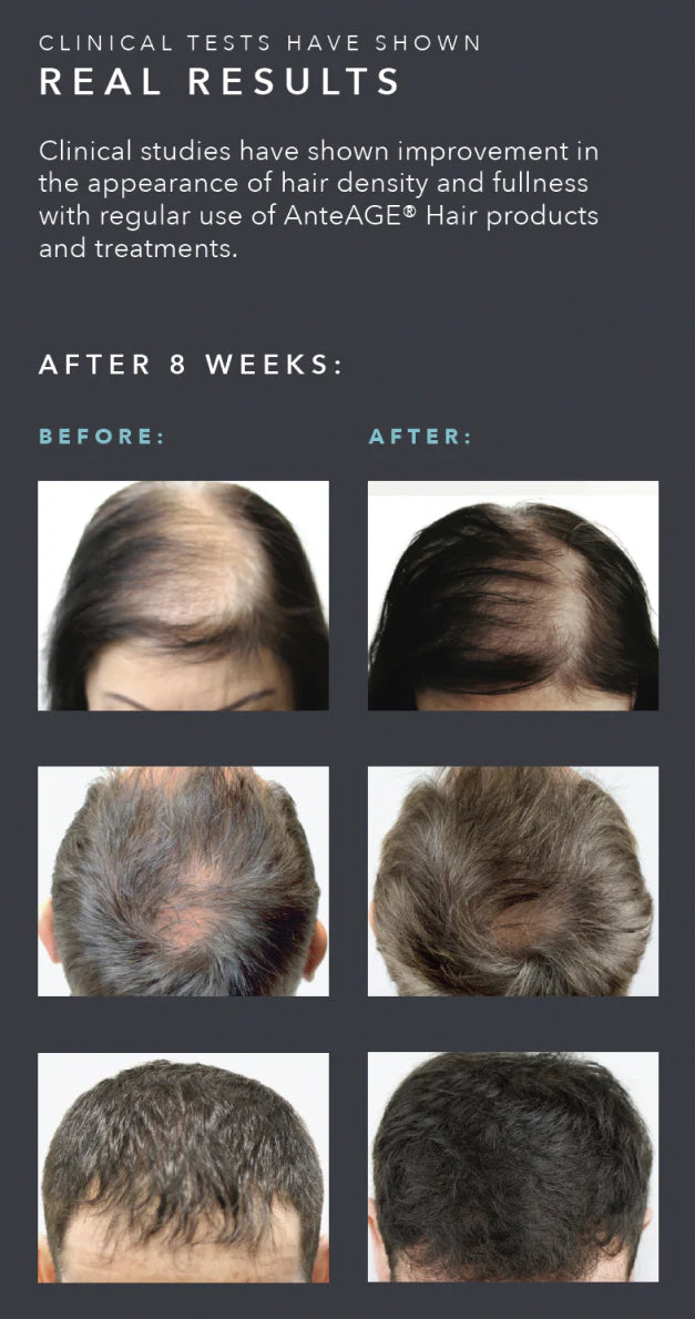 AnteAGE MD Hair Solution