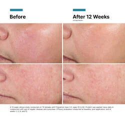 NEW:  Skin Ceuticals Advanced RGN-6 cream 50ml