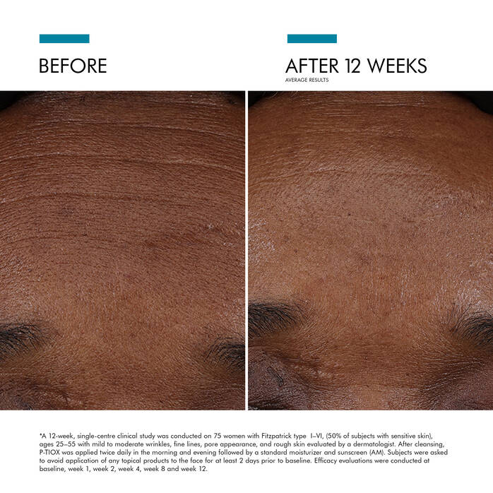 NEW: Skin Ceuticals P-TIOX Serum