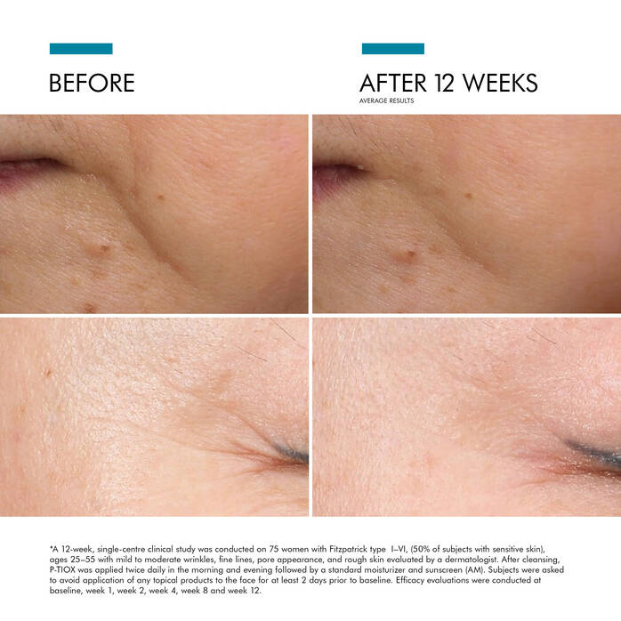 NEW: Skin Ceuticals P-TIOX Serum