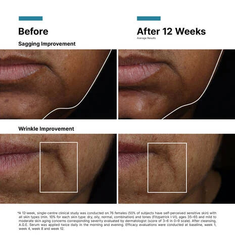NEW: Skin Ceuticals AGE Interrupter Ultra Serum