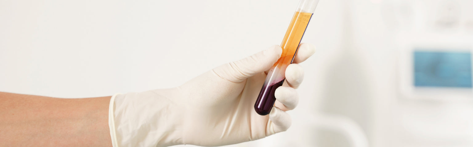 PRP Treatment treatment at Hush Beauty MD