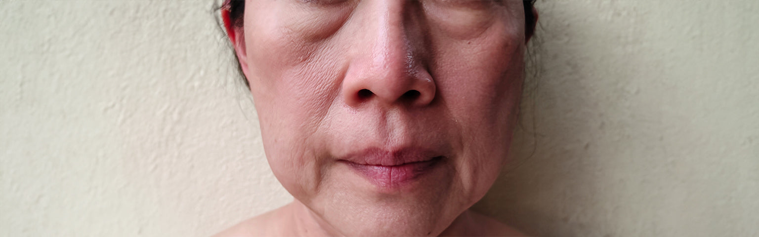 Skin Laxity and Sagginess treatment options at Hush Beauty MD