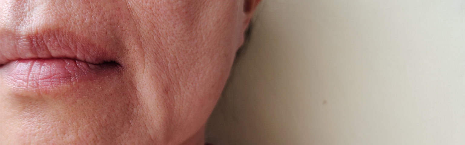 Volume Loss treatment options at Hush Beauty MD